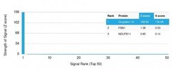 Uroplakin Ia Antibody (UPK1A/2924) - Azide and BSA Free, Novus Biologicals